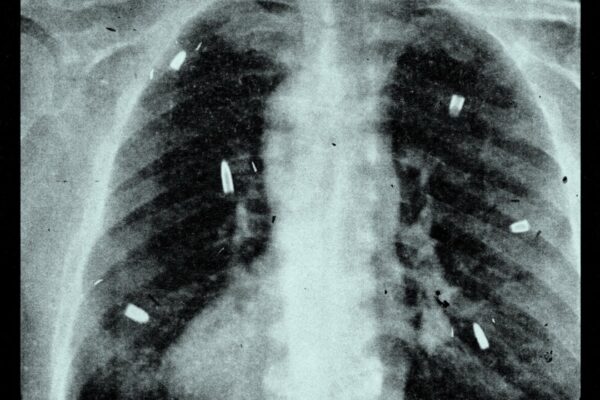 IDLES - Cheerleader - BestNewMusic2025 - New Music 2025 > Q3 > W35