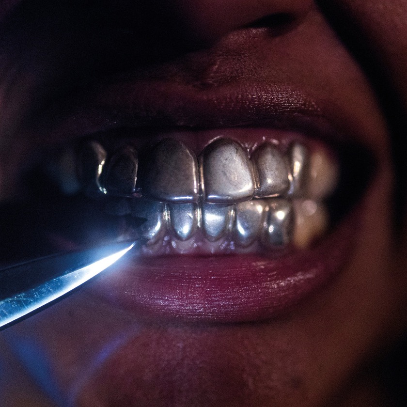 Upchuck - Tired - BestNewMusic2025 - New Music 2025 > Q3 > W35