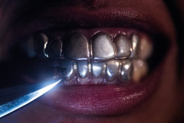 Upchuck - New Case - BestNewMusic2025 - New Music 2025 > Q4 > W40